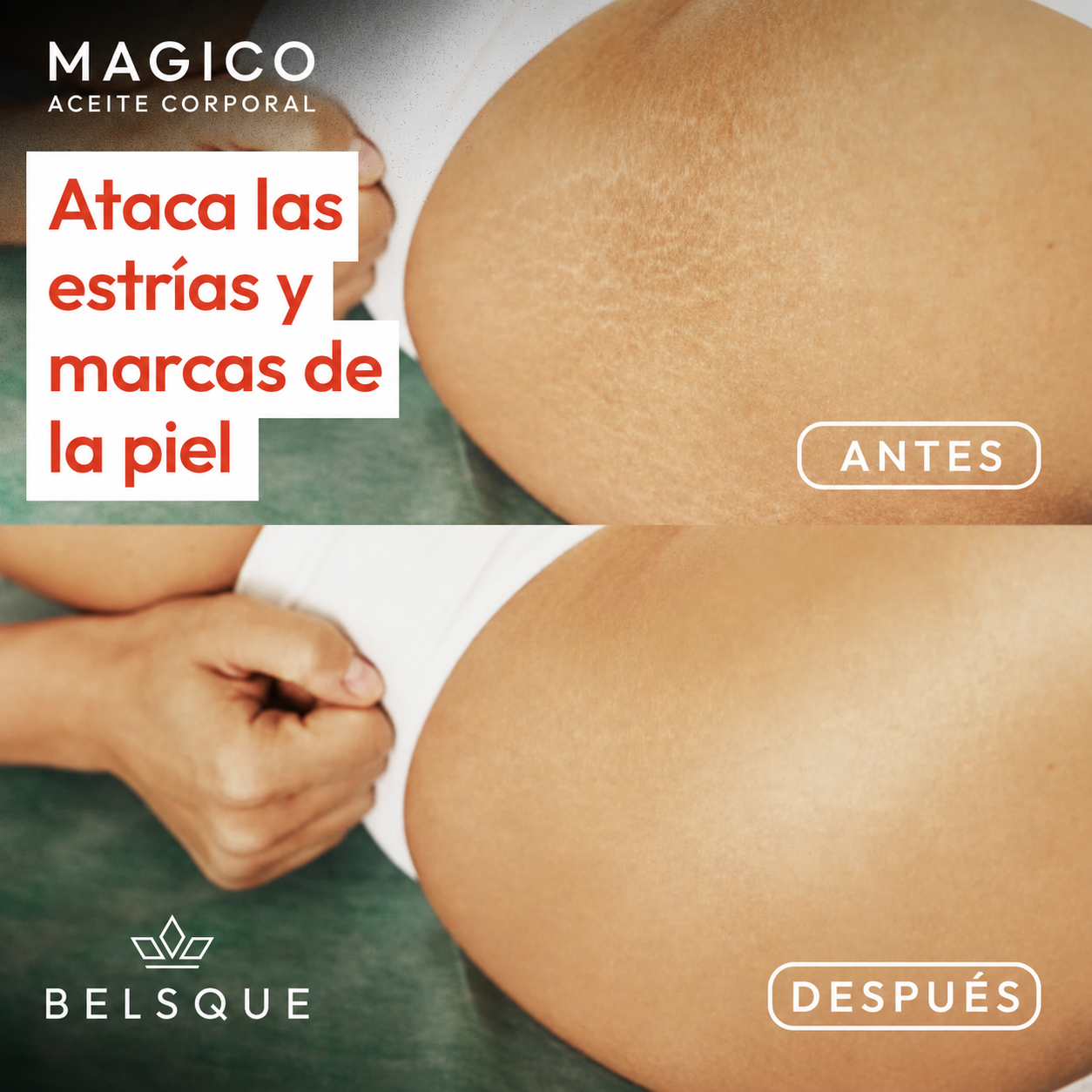 Aceite corporal Magico.
